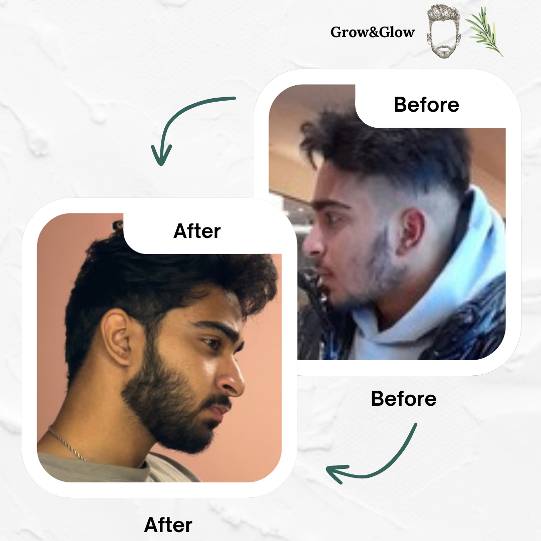 Beard Growth Oil (100ml)