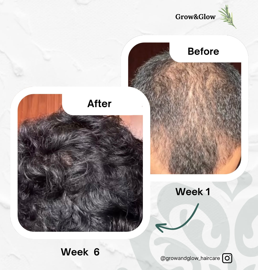 Hair Growth Oil + Hair Growth Oil